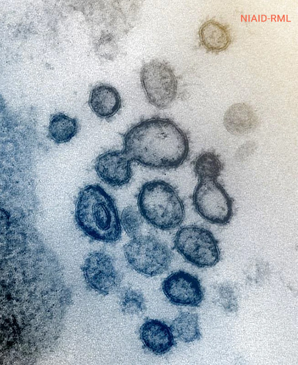 Вирус SARS-CoV-2
